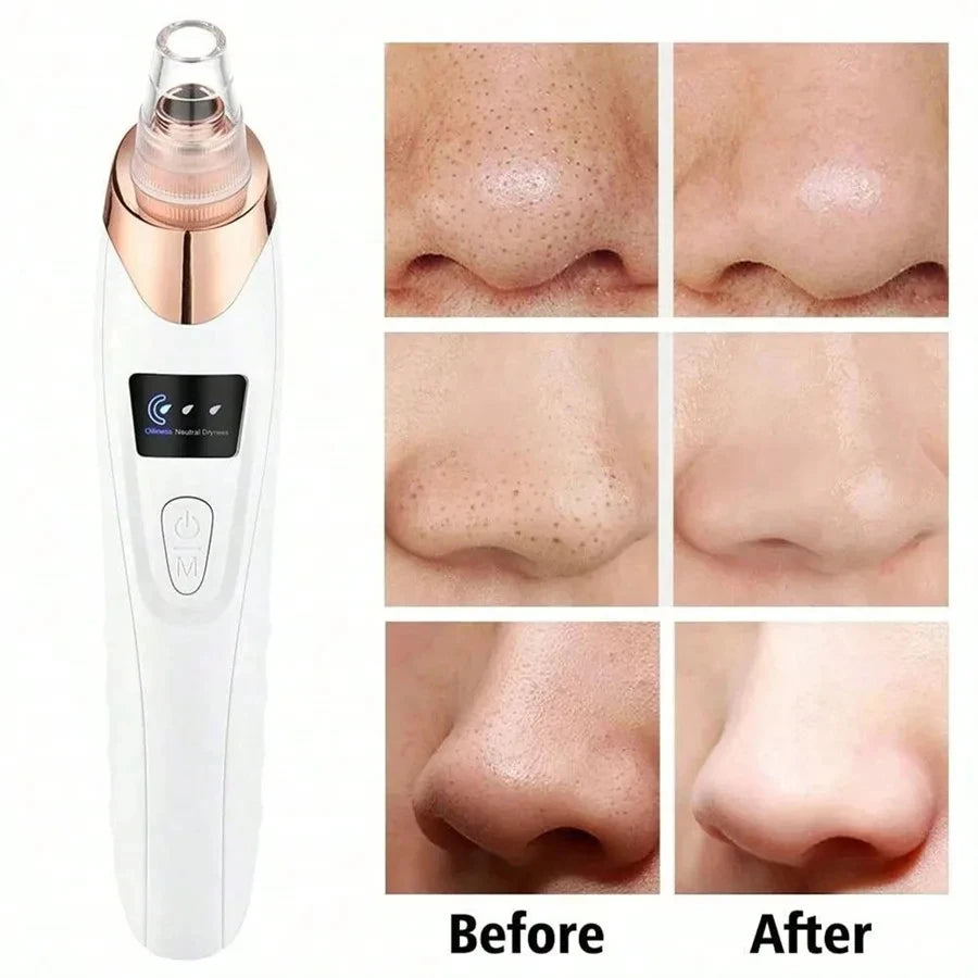 Electric Pore Cleaner & Blackhead Remover, Professional Deep Cleansing Vacuum Device for Facial Skincare, Pore Refining Tool