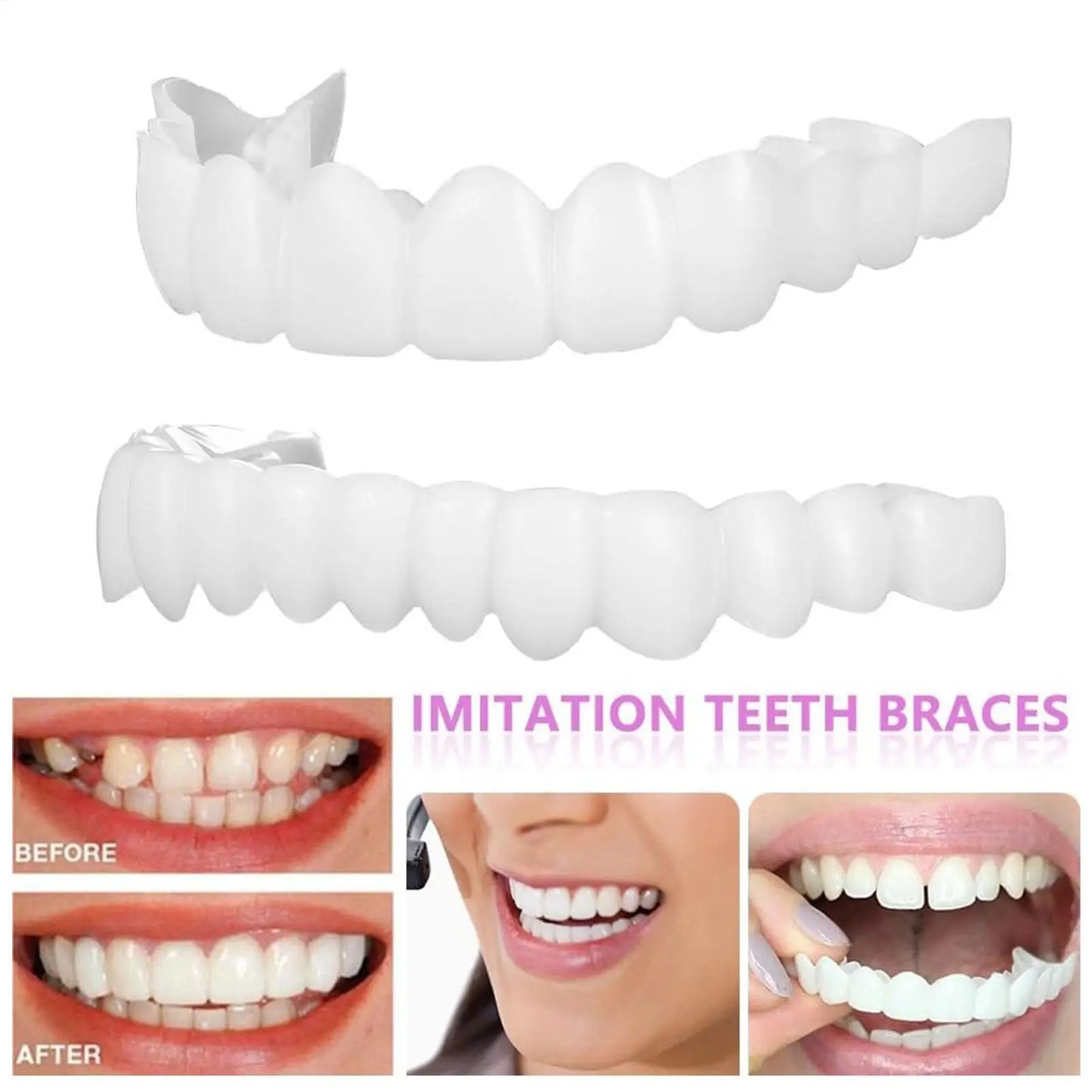 Dental Upper Lower Cover Bright Veneers Comfort Fit Flex Dentures Braces Whitening Replacement Smile Improver CK848-fro
