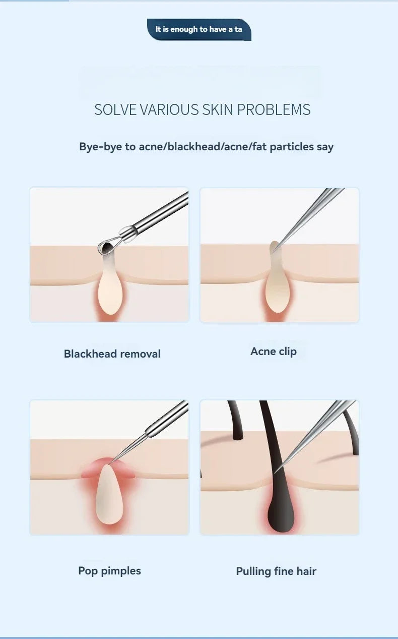 11Pcs/Set Acne Needle Blackhead Clip Remover Extraction Pore Black Head Cleaner Face Skin Care Cleansing Needle Tool Cell Clamp