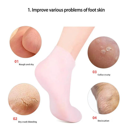 2 Pack Moisturizing Silicone Gel Socks for Dry Cracked Feet Nourishing Skin Lubricating Foot Care Massage Socks