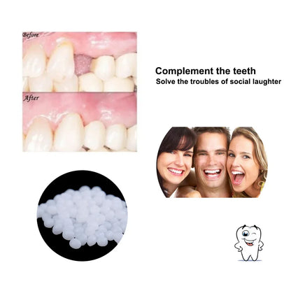 4 Colors Dental Oral False Fake Teeth Tooth Filling Repair Smile Snap on Veneers Dentures Case Paste Adhesive Beads Cosmetic