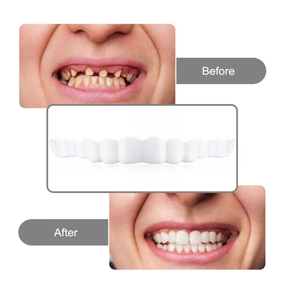 2 Pairs Silicone Denture Set Fit Temporary Orthodontic Teeth Dentures Fake Tooth Oral Hygiene Care Whitening Dentures Simulation