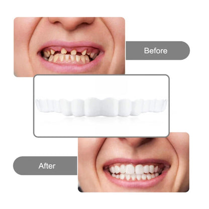 2 Pairs Silicone Denture Set Fit Temporary Orthodontic Teeth Dentures Fake Tooth Oral Hygiene Care Whitening Dentures Simulation