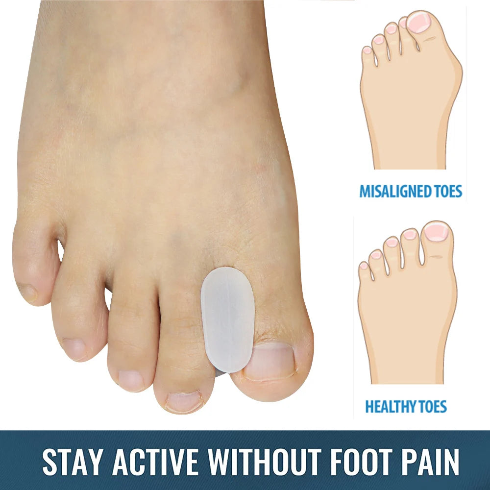 Pexmen 2/4Pcs Toe Spacers Separators Bunion Corrector Gel Toe Protector for Straightening Overlapping Toes for Men and Wom