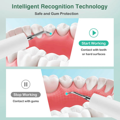 Intelligent Ultrasonic Dental Scaler Teeth Tartar Remover 5 Modes Electric LED Teeth Cleaner Tooth Stone Calculus Plaque Removal