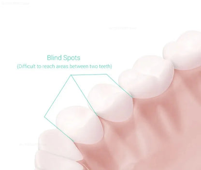 Xiaomi Mijia T300 Electric Toothbrush IPX7 Waterproof Smart Sonic Brush Ultrasonic Whitening Teeth Tooth Brush Toothbrushes