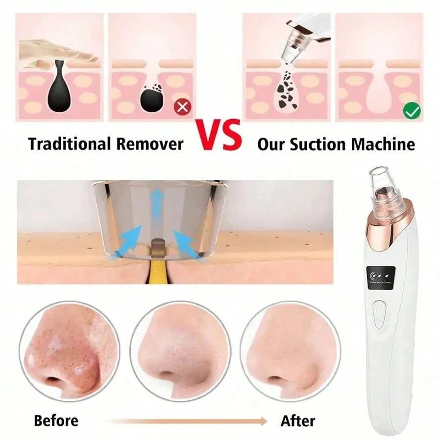 Electric Pore Cleaner & Blackhead Remover, Professional Deep Cleansing Vacuum Device for Facial Skincare, Pore Refining Tool