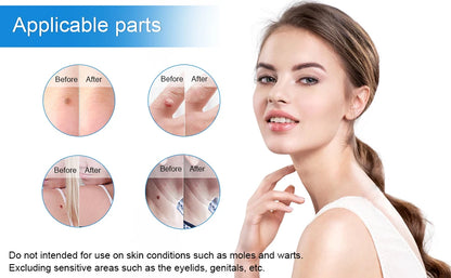Skin Tag Removal Mole Wart Removal Facial Mole Wart Microstrip Tag Removal Kit Automatic Mole Remover Tool with Cleansing Swabs