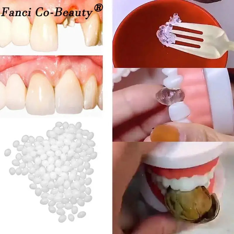 Resin 10g/15g/20g Teeth And Gaps FalseTeeth Solid Glue Temporary Tooth Repair Kit Denture Adhesive Teeth Whitening Tooth Beauty