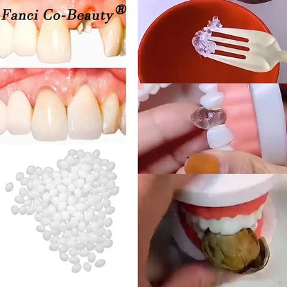Resin 10g/15g/20g Teeth And Gaps FalseTeeth Solid Glue Temporary Tooth Repair Kit Denture Adhesive Teeth Whitening Tooth Beauty