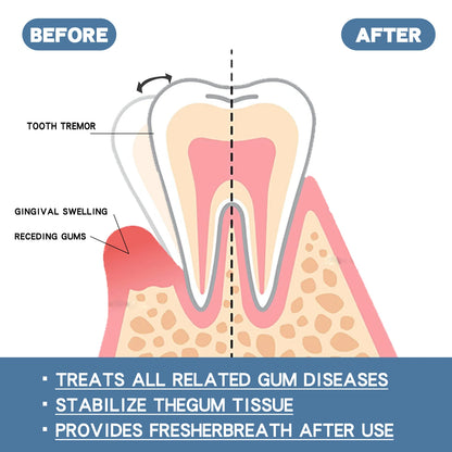 Rapid Repair Gums Serum Effectively Relieve Tooth Allergy Dental Caries Tooth Cleaning Toothpaste Relieve Tooth Damage Drops