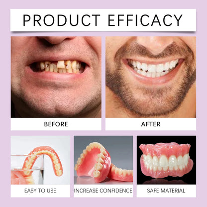 Silicone Denture Set Fit Temporary Orthodontic Teeth Dentures Fake Tooth Oral Hygiene Care Whitening Dentures Simulation Braces