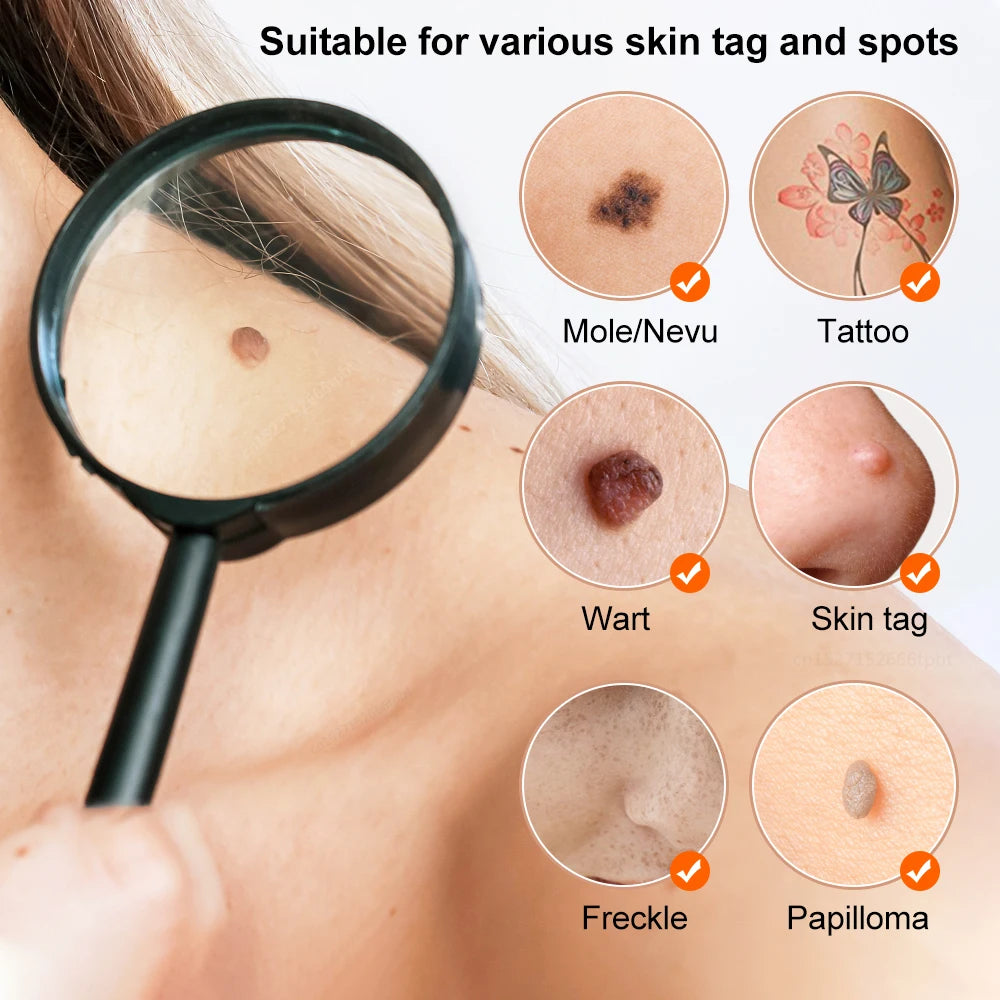 Plasma Pen Skin Tag Remover Mole Removal Wart Spots Dark Dpot Black Dot Nevus Freckle Flat Blemish Pimples Removal for Face Body