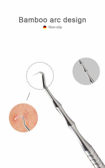 New German Acne Blackhead Removal Needles Pimples Blackhead Clip Tweezers Beauty Artifact Blemish Extractor Remover Needle Tool