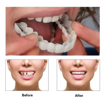 Snap-on Teeth Veneers Braces Box Kit, Snap-on Fake Teeth Veneers Braces Box Teeth Whitening Dental Care for Adults