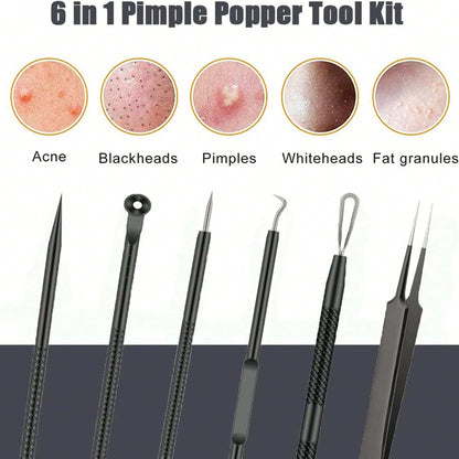 6-Piece Acne Tool Set Blackhead Extractor Facial Care - Facial Acne Removal Tweezers and Needle Stainless Steel Care Tools