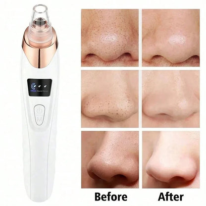 Electric Pore Cleaner & Blackhead Remover, Professional Deep Cleansing Vacuum Device for Facial Skincare, Pore Refining Tool