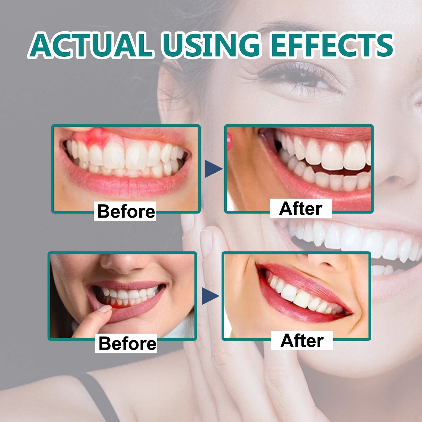 Gingival repair drops Quickly Repair of Cavities Caries Teeth Whiten Remove Yellow Plaque Stains Relieve Gums Decay Toothpaste