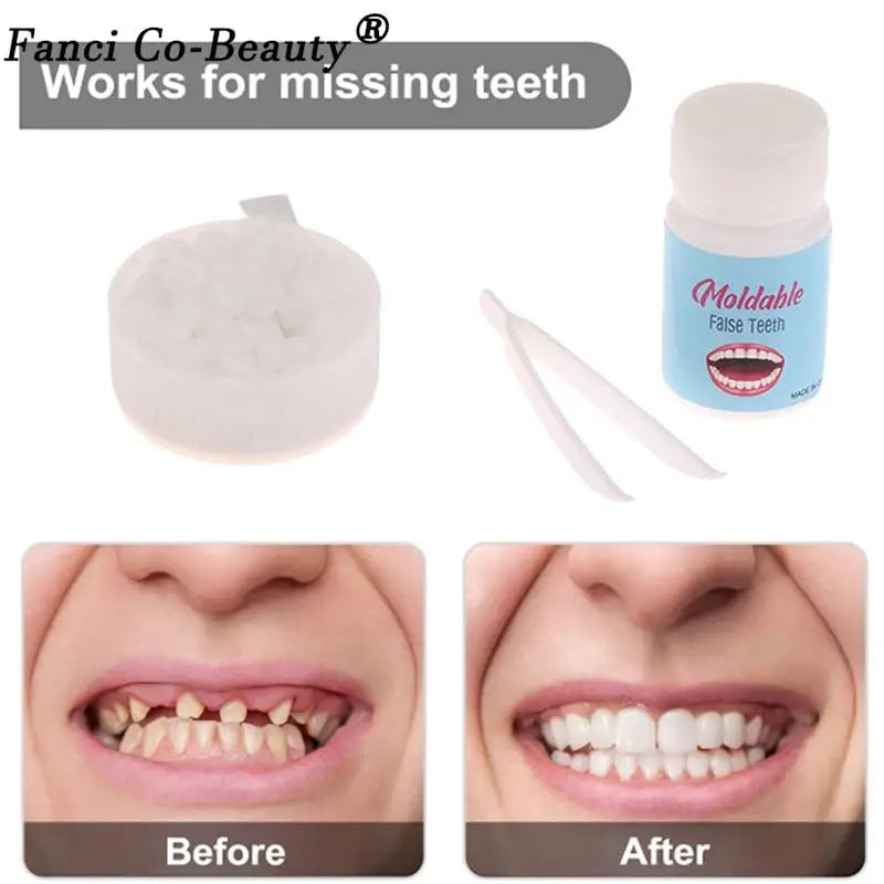 Resin 10g/15g/20g Teeth And Gaps FalseTeeth Solid Glue Temporary Tooth Repair Kit Denture Adhesive Teeth Whitening Tooth Beauty