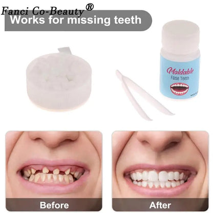 Resin 10g/15g/20g Teeth And Gaps FalseTeeth Solid Glue Temporary Tooth Repair Kit Denture Adhesive Teeth Whitening Tooth Beauty