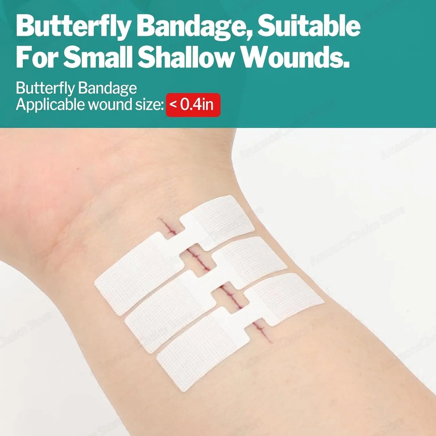 Sanke Rescue 1/14/28 Pack Wound Closure Strips Zipper Bandages Emergency Laceration for IFAK First Aid Kit Repair Wounds Device