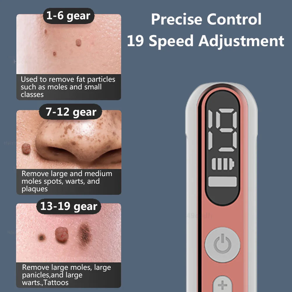 Plasma Pen Skin Tag Remover Mole Removal Wart Spots Dark Dpot Black Dot Nevus Freckle Flat Blemish Pimples Removal for Face Body