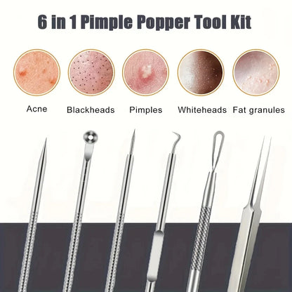 6-Pack Stainless Steel Acne Needles and Blackhead Removal Tools - Pore Cleansing Tools for Professional Facial Skin Beauty Care