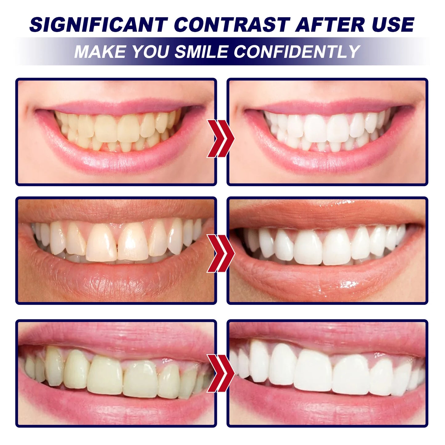 Teeth W-hitening Stickers Mint W-hite Teeth Gel Tooth W-hitener Strips Teeth Yellow Smoke Stains Tea Stains Oral Hygiene Care