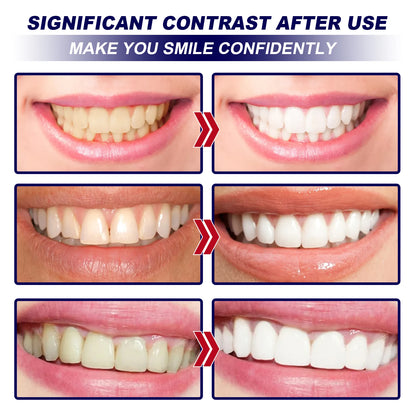 Teeth W-hitening Stickers Mint W-hite Teeth Gel Tooth W-hitener Strips Teeth Yellow Smoke Stains Tea Stains Oral Hygiene Care