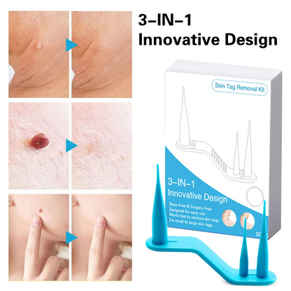 Skin Tag Removal Mole Wart Removal Facial Mole Wart Microstrip Tag Removal Kit Automatic Mole Remover Tool with Cleansing Swabs