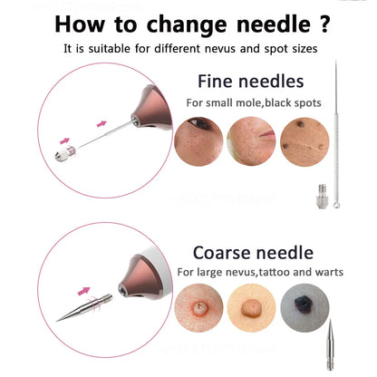 Plasma Pen Skin Tag Remover Mole Removal Wart Spots Dark Dpot Black Dot Nevus Freckle Flat Blemish Pimples Removal for Face Body