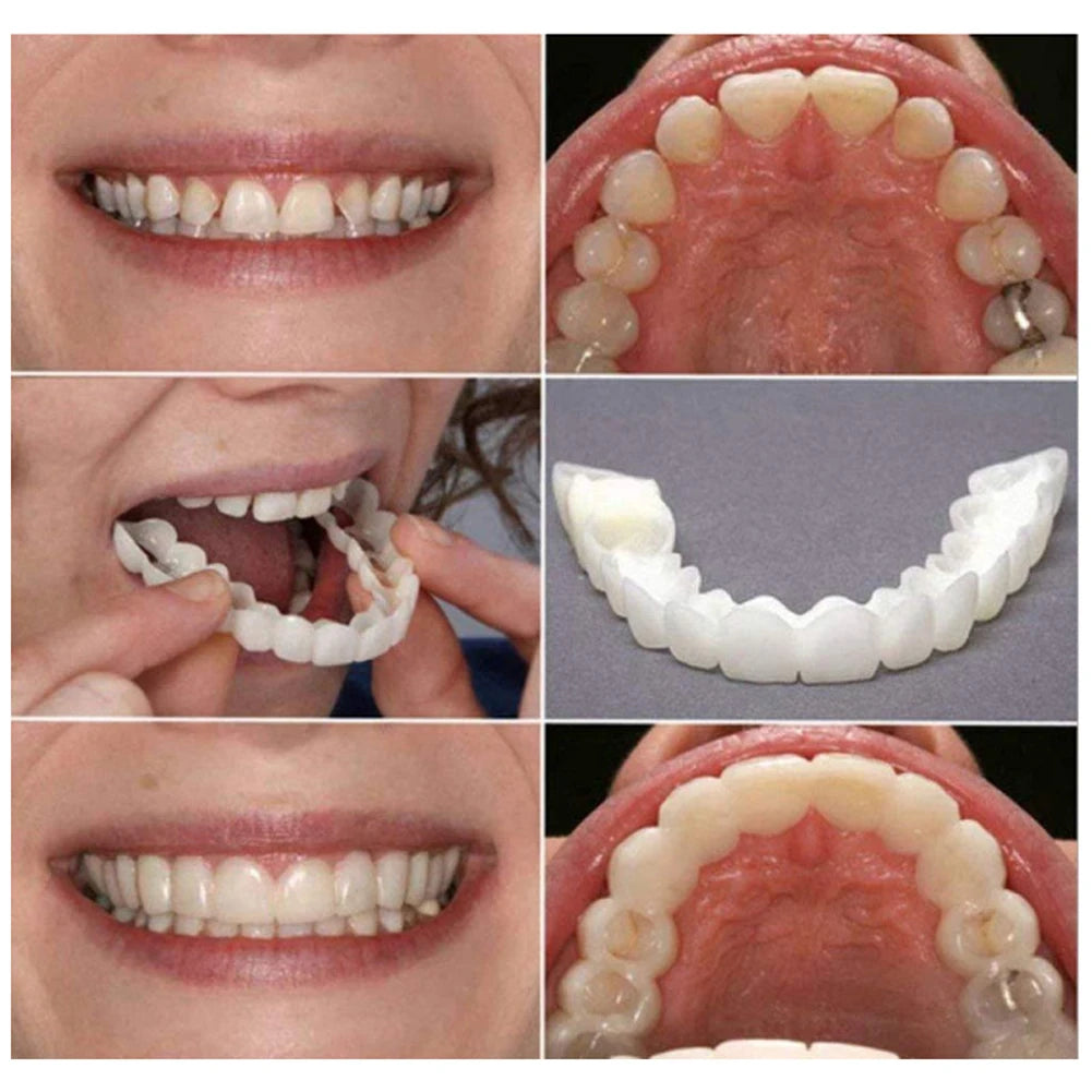 2 Pairs Silicone Denture Set Fit Temporary Orthodontic Teeth Dentures Fake Tooth Oral Hygiene Care Whitening Dentures Simulation