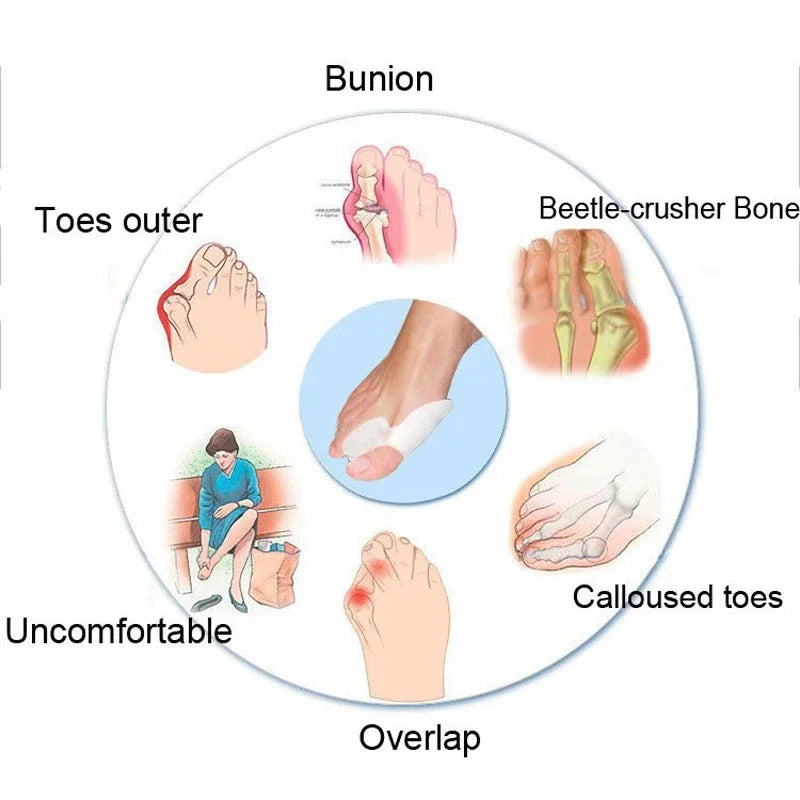 Silicone Gel Thumb Corrector Little Toe Protector Separator Valgus Finger Straightener Foot Care Relief Pads tool