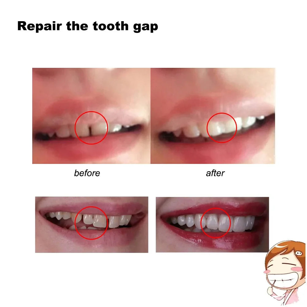 4 Colors Dental Oral False Fake Teeth Tooth Filling Repair Smile Snap on Veneers Dentures Case Paste Adhesive Beads Cosmetic