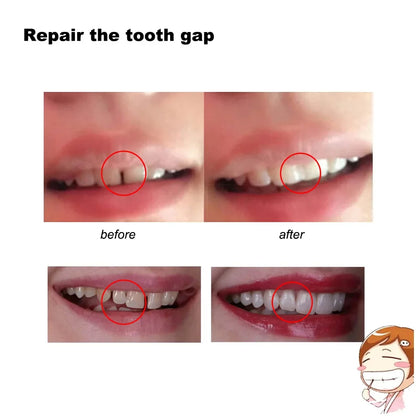 4 Colors Dental Oral False Fake Teeth Tooth Filling Repair Smile Snap on Veneers Dentures Case Paste Adhesive Beads Cosmetic
