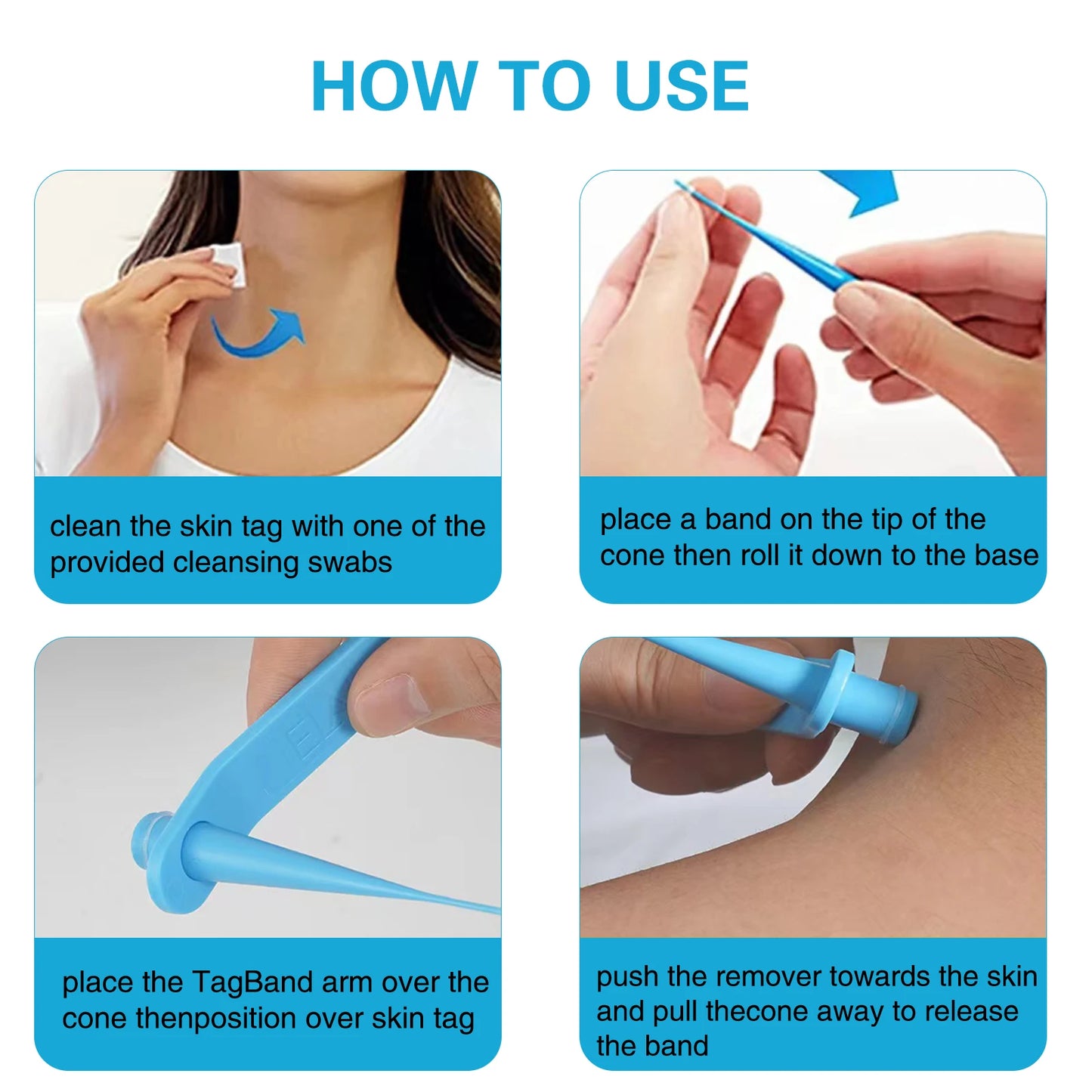 Skin Tag Removal Mole Wart Removal Facial Mole Wart Microstrip Tag Removal Kit Automatic Mole Remover Tool with Cleansing Swabs