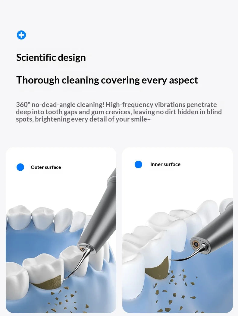 HOMEFISH Home Dental Cleaning Device Professional Tool for Removing Tartar Plaque And Calculus with Visual Technology