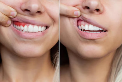 Gingival repair drops Quickly Repair of Cavities Caries Teeth Whiten Remove Yellow Plaque Stains Relieve Gums Decay Toothpaste