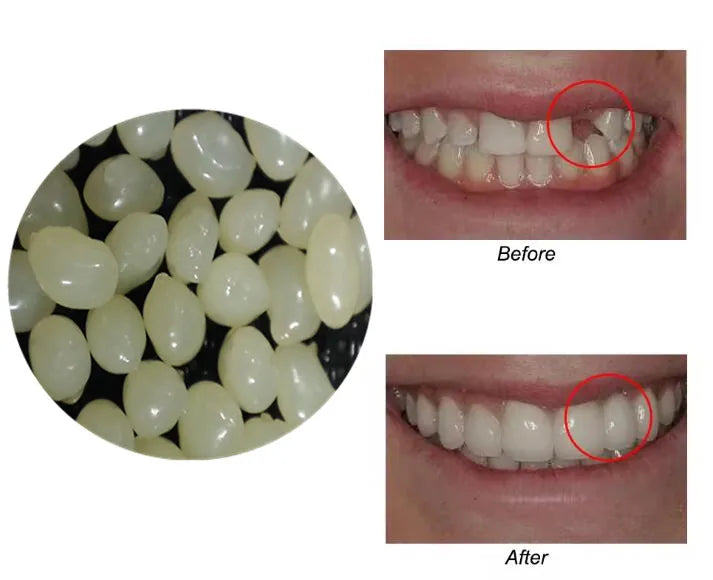 4 Colors Dental Oral False Fake Teeth Tooth Filling Repair Smile Snap on Veneers Dentures Case Paste Adhesive Beads Cosmetic