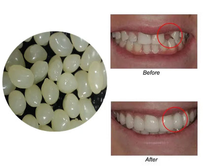 4 Colors Dental Oral False Fake Teeth Tooth Filling Repair Smile Snap on Veneers Dentures Case Paste Adhesive Beads Cosmetic