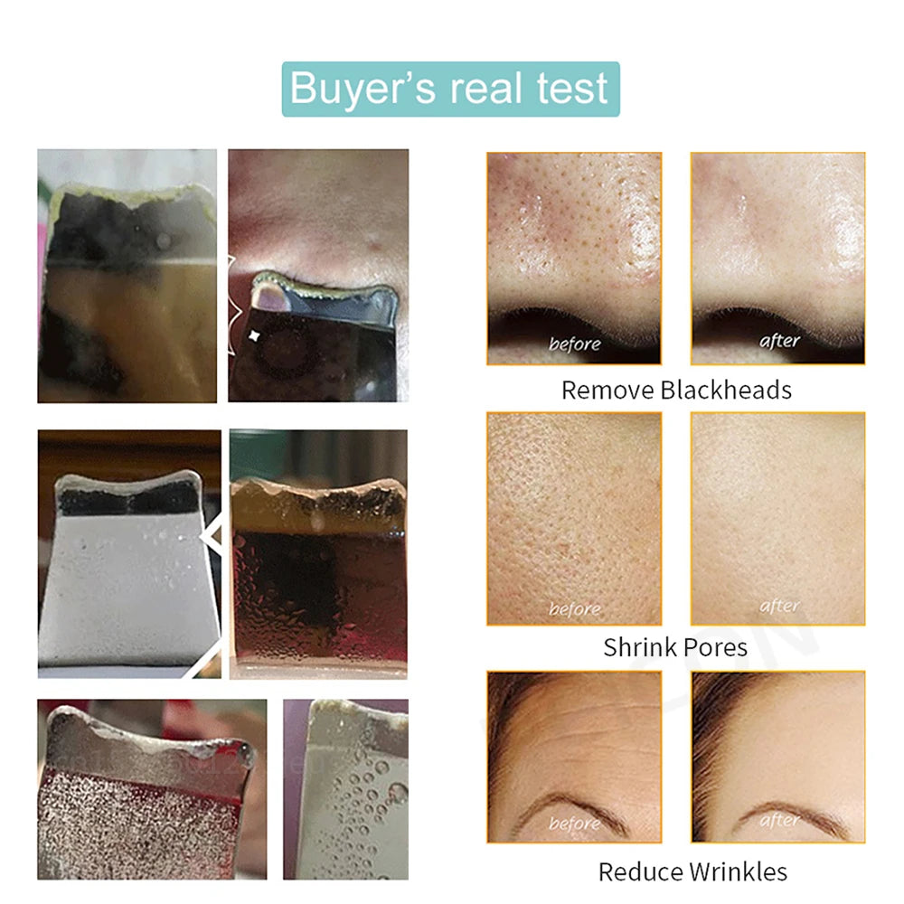 Ultrasonic Skin Scrubber Facial Peeling Machine Black Dots Acne Pore Deep Cleaning Ultrasonic Face Scrubber Blackhead Remover