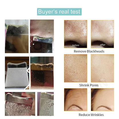 Ultrasonic Skin Scrubber Facial Peeling Machine Black Dots Acne Pore Deep Cleaning Ultrasonic Face Scrubber Blackhead Remover