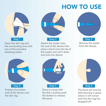 Skin Tag Removal Mole Wart Removal Facial Mole Wart Microstrip Tag Removal Kit Automatic Mole Remover Tool with Cleansing Swabs