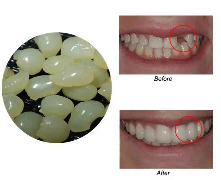 4 Colors Dental Oral False Fake Teeth Tooth Filling Repair Smile Snap on Veneers Dentures Case Paste Adhesive Beads Cosmetic