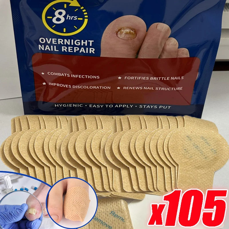 21pcs Nail Fungus Patch Waterproof Nail Repair Patch Ingrown Correction Sticker Damaged Nail Gray Care Patch Feet Care Tools