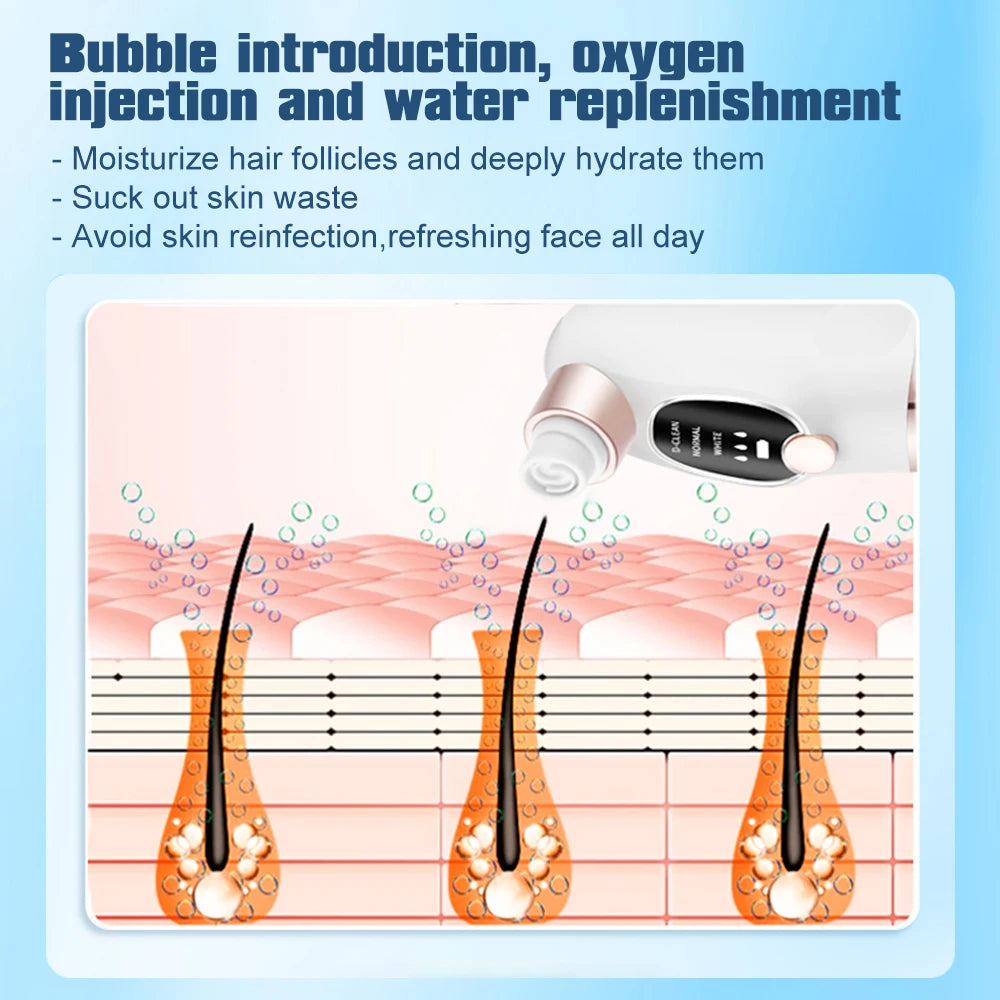 Electric Blackhead Remover Pore Vacuum Cleaner Facial Black Dots Vacuum Cleaner Acne Pimple Blackhead Removal Black Dots Remover