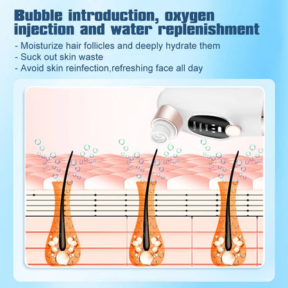Electric Blackhead Remover Pore Vacuum Cleaner Facial Black Dots Vacuum Cleaner Acne Pimple Blackhead Removal Black Dots Remover