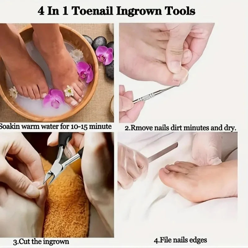 Nail Clippers Professional Hawkbill with Nail Pick Trimmer for Ingrown Toenails Paronychia Cutter for Unisex Home Foot Care Tool