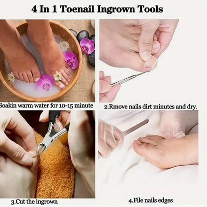 Nail Clippers Professional Hawkbill with Nail Pick Trimmer for Ingrown Toenails Paronychia Cutter for Unisex Home Foot Care Tool