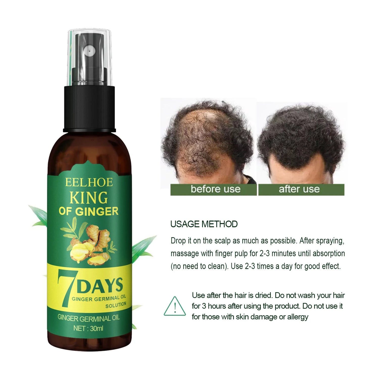 Ginger Oil Hair Booster Serum Spray Nourish Scalp Hair Follicles Refresh Control Oil Strengthen Hair Roots Nutrient Solution